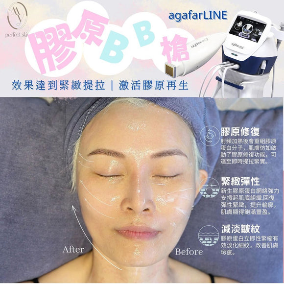 MY Perfect Skin Beauty | Agafar Line Collagen Regeneration BB Gun Facial Treatment