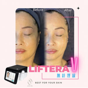 MY Perfect Skin Beauty | Liftera V 極度緊緻提升面部療程